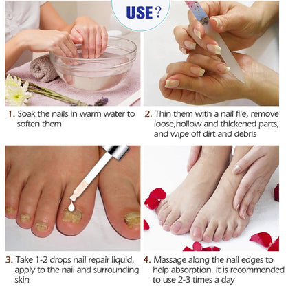Thickening Soft With Special Bacteriostatic Liquid For Gray Nails
