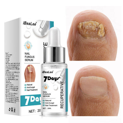 Thickening Soft With Special Bacteriostatic Liquid For Gray Nails