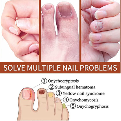 Thickening Soft With Special Bacteriostatic Liquid For Gray Nails